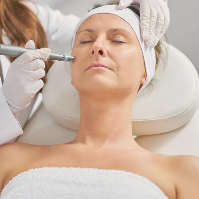 Microneedling 3 sessions Package